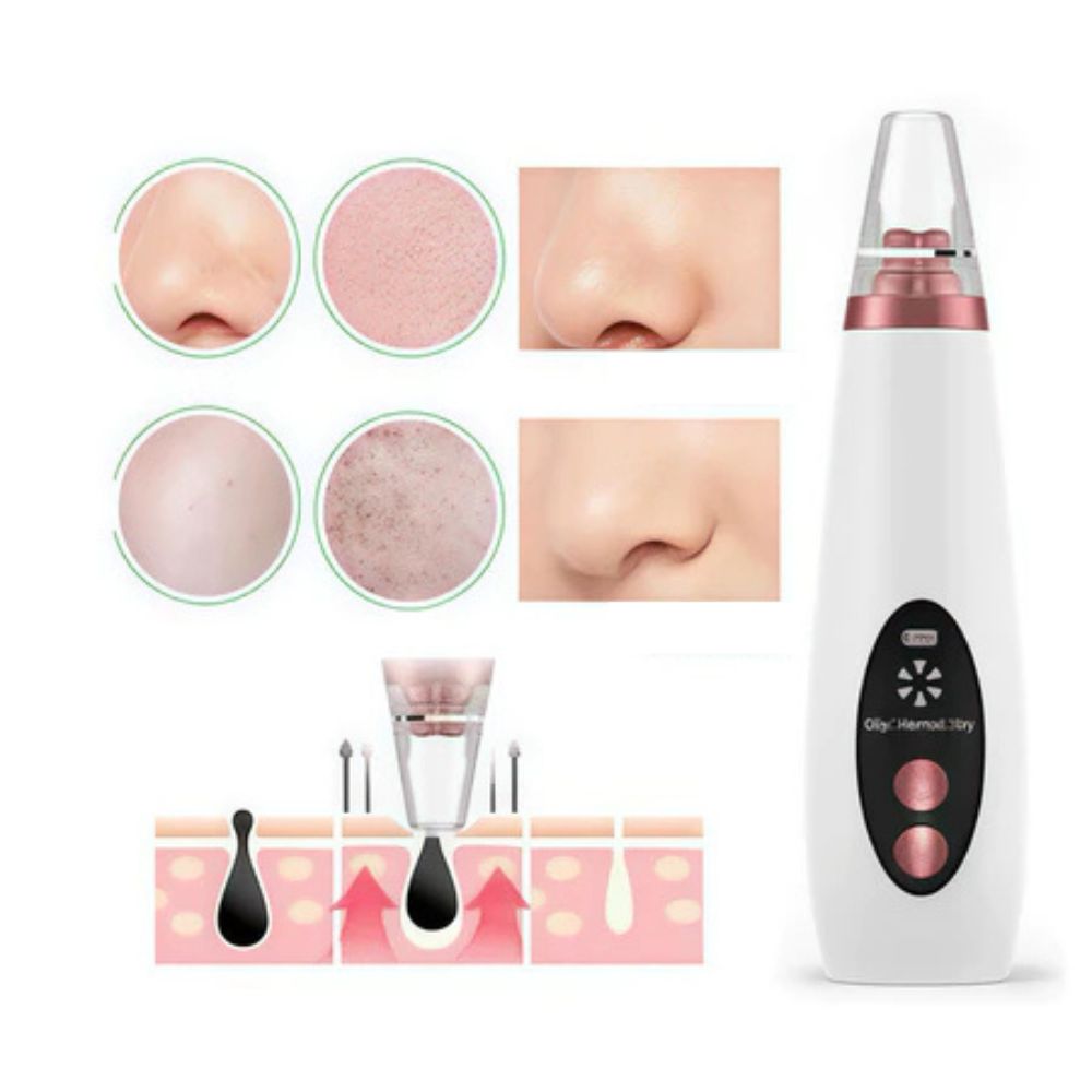 Removedor Elétrico de Cravos e Espinhas A Vácuo Recarregável